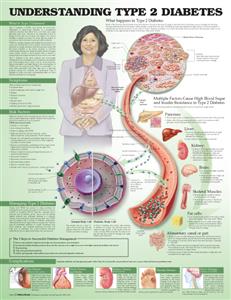 Understanding Type 2 Diabetes Anatomical Chart