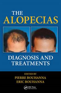 The Alopecias - Click Image to Close