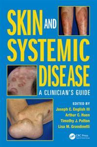 Skin and Systemic Disease - Click Image to Close