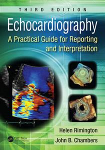 Echocardiography - Click Image to Close