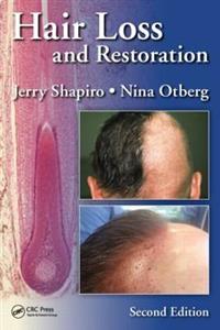 Hair Loss and Restoration - Click Image to Close