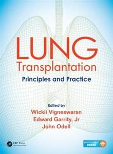 Lung Transplantation - Click Image to Close