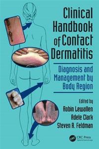 Clinical Handbook of Contact Dermatitis - Click Image to Close