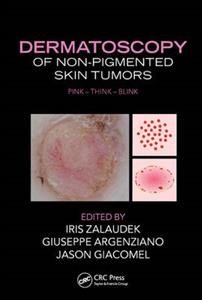 Dermatoscopy of Non-Pigmented Skin Tumors - Click Image to Close