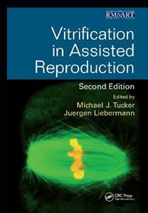 Vitrification in Assisted Reproduction - Click Image to Close