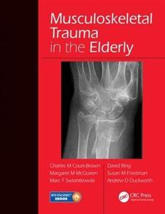 Musculoskeletal Trauma in the Elderly - Click Image to Close