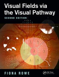 Visual Fields via the Visual Pathway - Click Image to Close