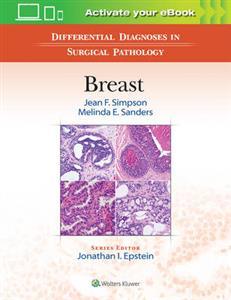 Differential Diagnoses in Surgical Pathology: Breast - Click Image to Close