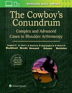 The Cowboy's Conundrum: Complex and Advanced Cases in Shoulder Arthroscopy - Click Image to Close