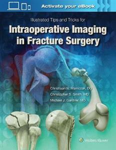 Illustrated Tips and Tricks for Intraoperative Imaging in Fracture Surgery - Click Image to Close