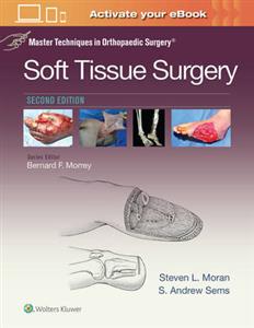 Master Techniques in Orthopaedic Surgery: Soft Tissue Surgery - Click Image to Close