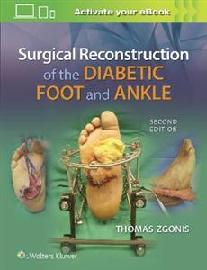 Surgical Reconstruction of the Diabetic Foot and Ankle - Click Image to Close