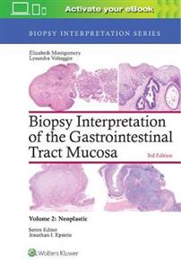 Biopsy Interpretation of the Gastrointestinal Tract Mucosa: Volume 2: Neoplastic - Click Image to Close