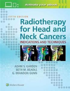 Radiotherapy for Head and Neck Cancers: Indications and Techniques - Click Image to Close