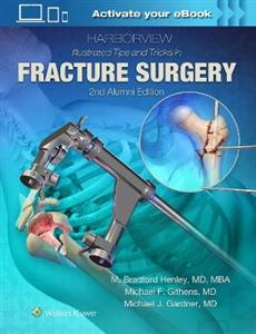 Harborview Illustrated Tips and Tricks in Fracture Surgery - Click Image to Close