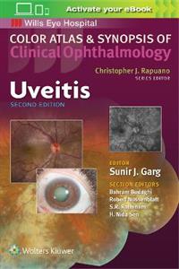 Uveitis (Color Atlas and Synopsis of Clinical Ophthalmology) - Click Image to Close