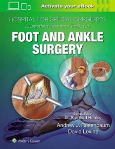 Hospital for Special Surgery's Illustrated Tips and Tricks in Foot and Ankle Surgery - Click Image to Close