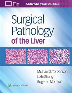 Surgical Pathology of the Liver - Click Image to Close
