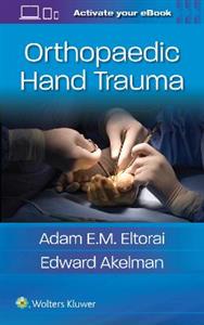 Orthopaedic Hand Trauma - Click Image to Close