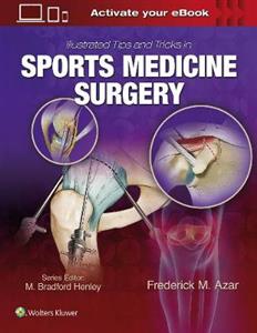 Illustrated Tips and Tricks in Sports Medicine Surgery - Click Image to Close