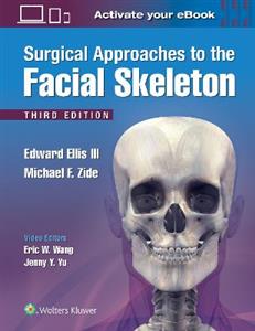 Surgical Approaches to the Facial Skeleton - Click Image to Close