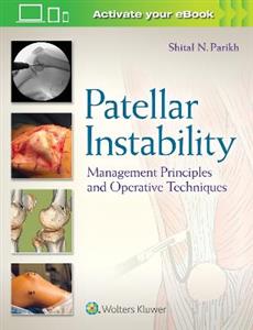 Patellar Instability - Click Image to Close