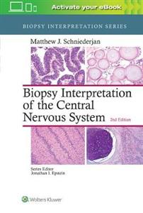 Biopsy Interpretation of the Central Nervous System (Biopsy Interpretation Series) - Click Image to Close