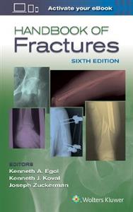 Handbook of Fractures, - Click Image to Close