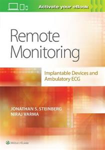 Remote Monitoring: implantable Devices and Ambulatory ECG - Click Image to Close