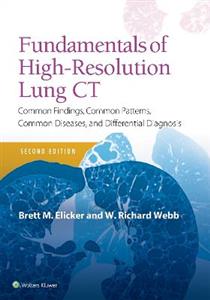 Fundamentals of High-Resolution Lung CT - Click Image to Close
