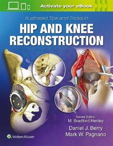 Illustrated Tips and Tricks in Hip and Knee Reconstructive and Replacement Surgery - Click Image to Close