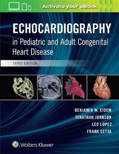 Echocardiography in Pediatric and Adult Congenital Heart Disease - Click Image to Close