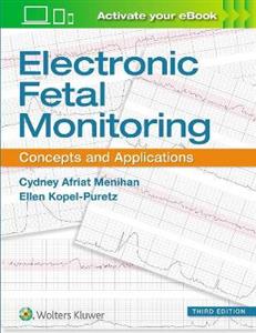 Electronic Fetal Monitoring - Click Image to Close