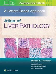 Atlas of Liver Pathology: A Pattern-Based Approach - Click Image to Close
