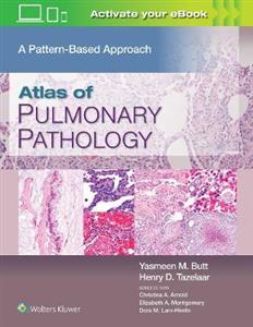 Atlas of Pulmonary Pathology - Click Image to Close