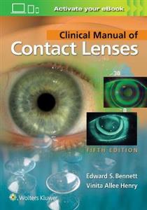 Clinical Manual of Contact Lenses - Click Image to Close