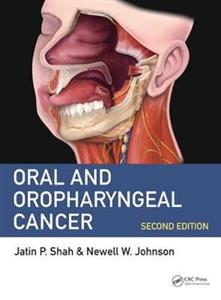 Oral and Oropharyngeal Cancer