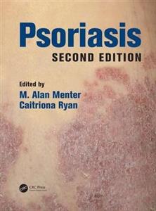 Psoriasis - Click Image to Close