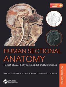 Human Sectional Anatomy - Click Image to Close
