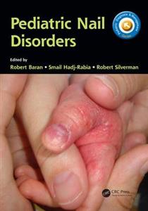 Pediatric Nail Disorders - Click Image to Close