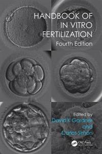 Handbook of In Vitro Fertilization - Click Image to Close