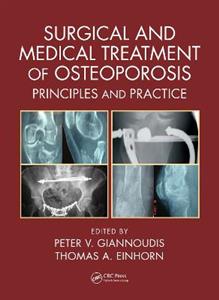 Surgical and Medical Treatment of Osteoporosis - Click Image to Close