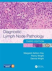 Diagnostic Lymph Node Pathology - Click Image to Close