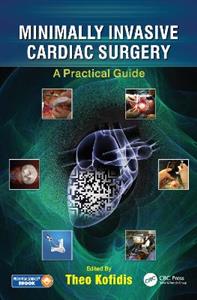 Minimally Invasive Cardiac Surgery - Click Image to Close