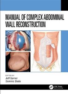 Manual of Complex Abdominal Wall Reconstruction - Click Image to Close