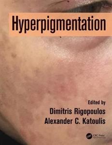 Hyperpigmentation - Click Image to Close