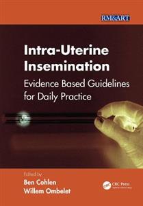 Intra-Uterine Insemination: Evidence Based Guidelines for Daily Practice - Click Image to Close