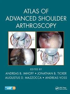 Atlas of Advanced Shoulder Arthroscopy - Click Image to Close