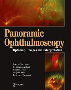 Panoramic Ophthalmoscopy