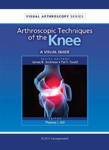 Arthroscopic Techniques of the Knee: A Visual Guide